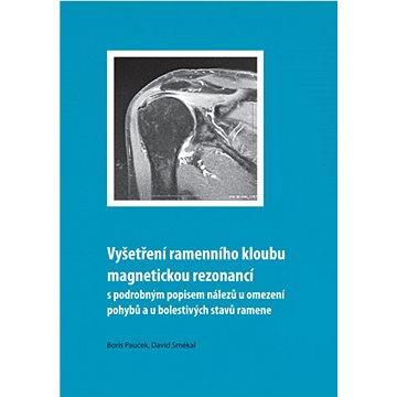 Vyšetření ramenního kloubu magnetickou rezonancí s podrobným popisem nálezů u omezení pohybů u boles
Vyšetření ramenního kloubu magnetickou rezonancí s podrobným popisem nálezů u omezení pohybů u boles