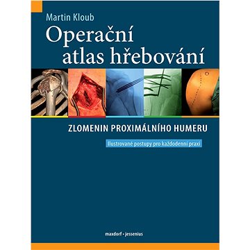 Operační atlas hřebování zlomenin proximálního humeru: Ilustrované postupy pro každodenní praxi
Operační atlas hřebování zlomenin proximálního humeru: Ilustrované postupy pro každodenní praxi