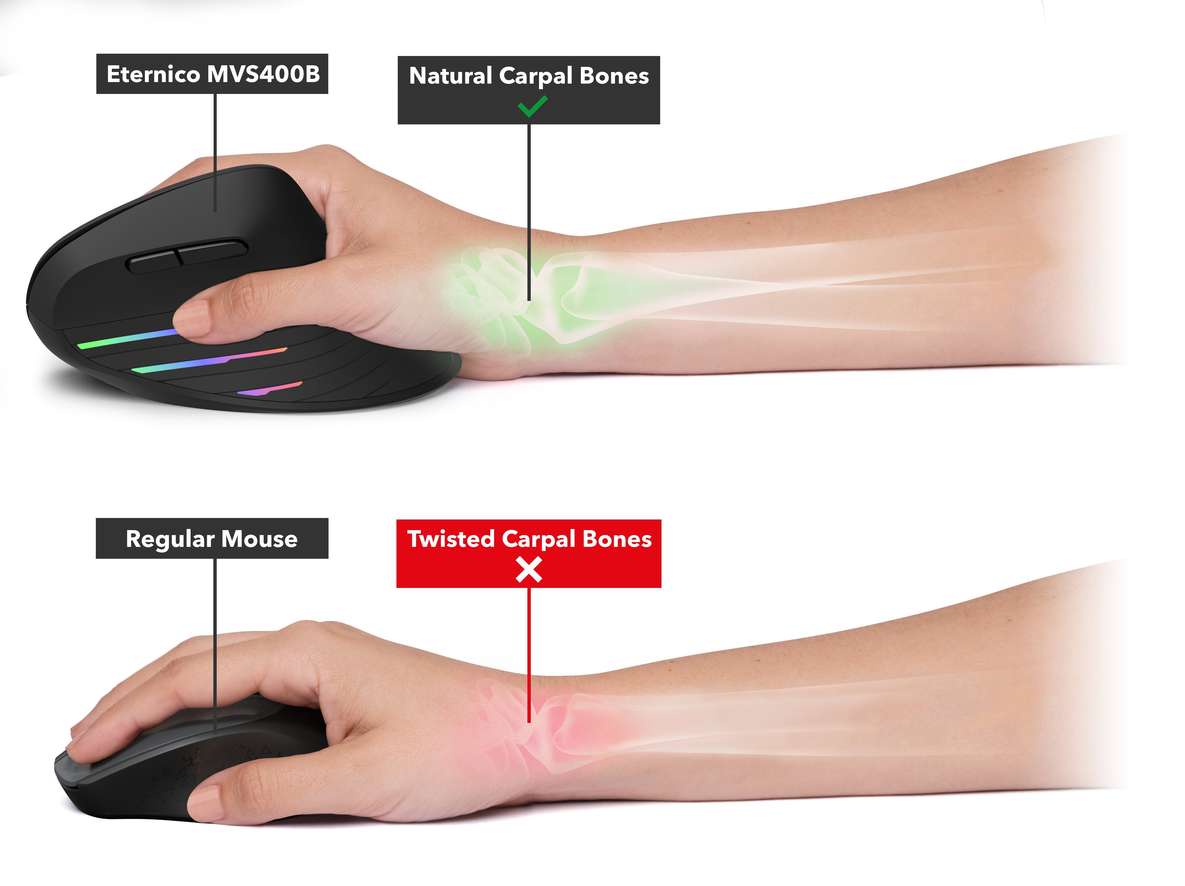 Myš Eternico Rechargeable Vertical Mouse MV400 černá