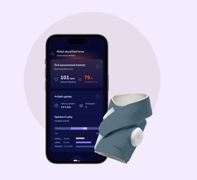 Chytrá ponožka Owlet Dream Sock 0-18 měsíců (Modrá)