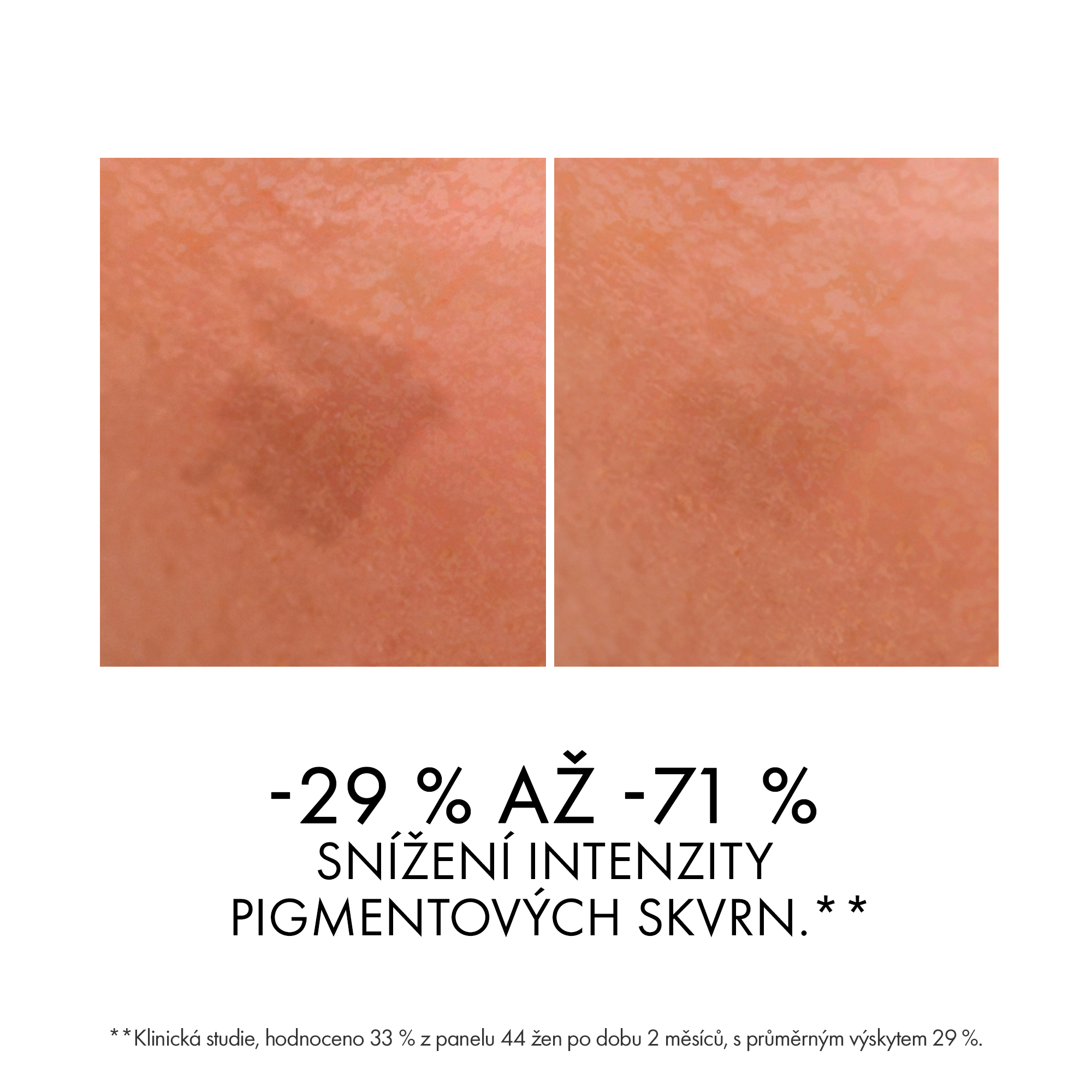Pleťové sérum VICHY Liftactiv Specialist B3 Sérum 30 ml