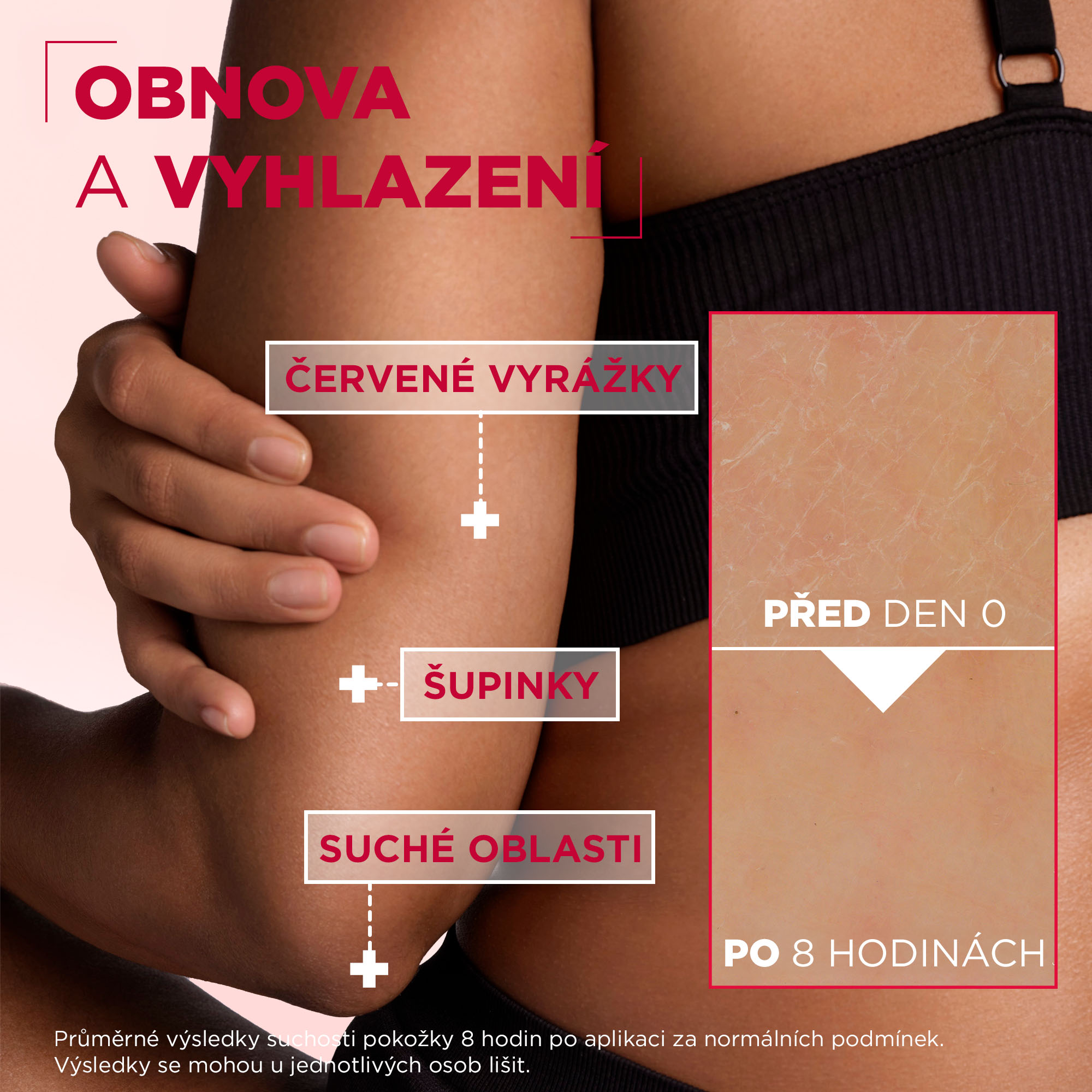 Tělový krém MIXA Urea Cica Repair+ 400 ml