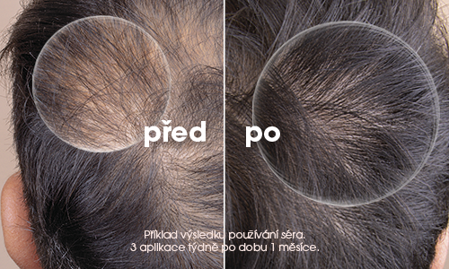 Sérum na vlasy KLORANE Sérum při vypadávání vlasů s chininem a BIO protěží alpskou 100 ml