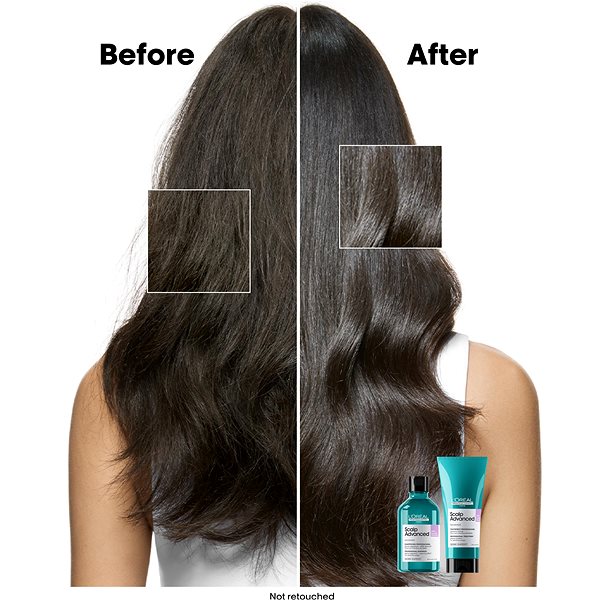 Shampoo L'ORÉAL PROFESSIONNEL Scalp Advanced refill 500 ml .