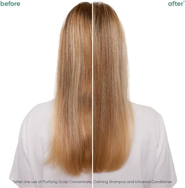 Šampón BIOLAGE Scalp Sync Upokojujúci šampón 250 ml .