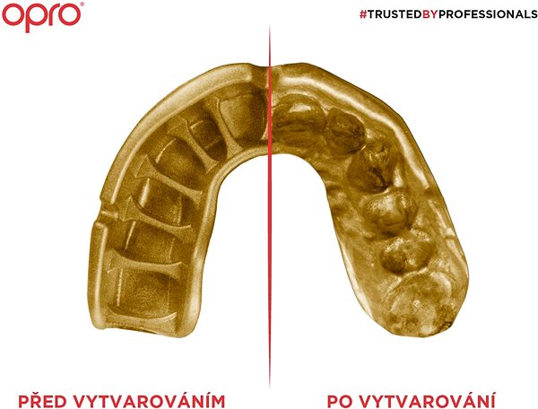 Fogvédő Opro Gold Junior, fekete/arany ...