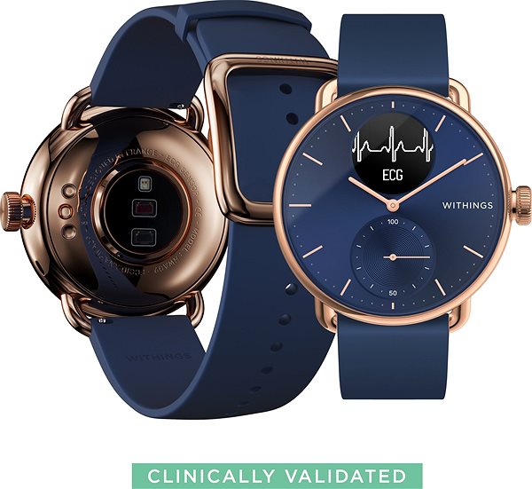 Okosóra Withings Scanwatch 38mm - Rose Gold Blue Oldalnézet