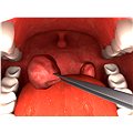 Surgery Simulator 2011 - Hra na PC