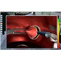 Surgery Simulator 2011 - Hra na PC