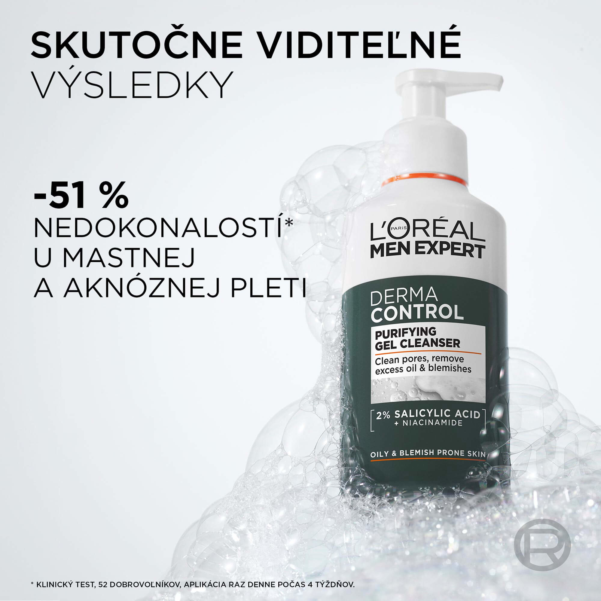 Pleťové sérum L´ORÉAL PARIS Men Expert Derma Control Niacinamide Anti-blemish 30 ml