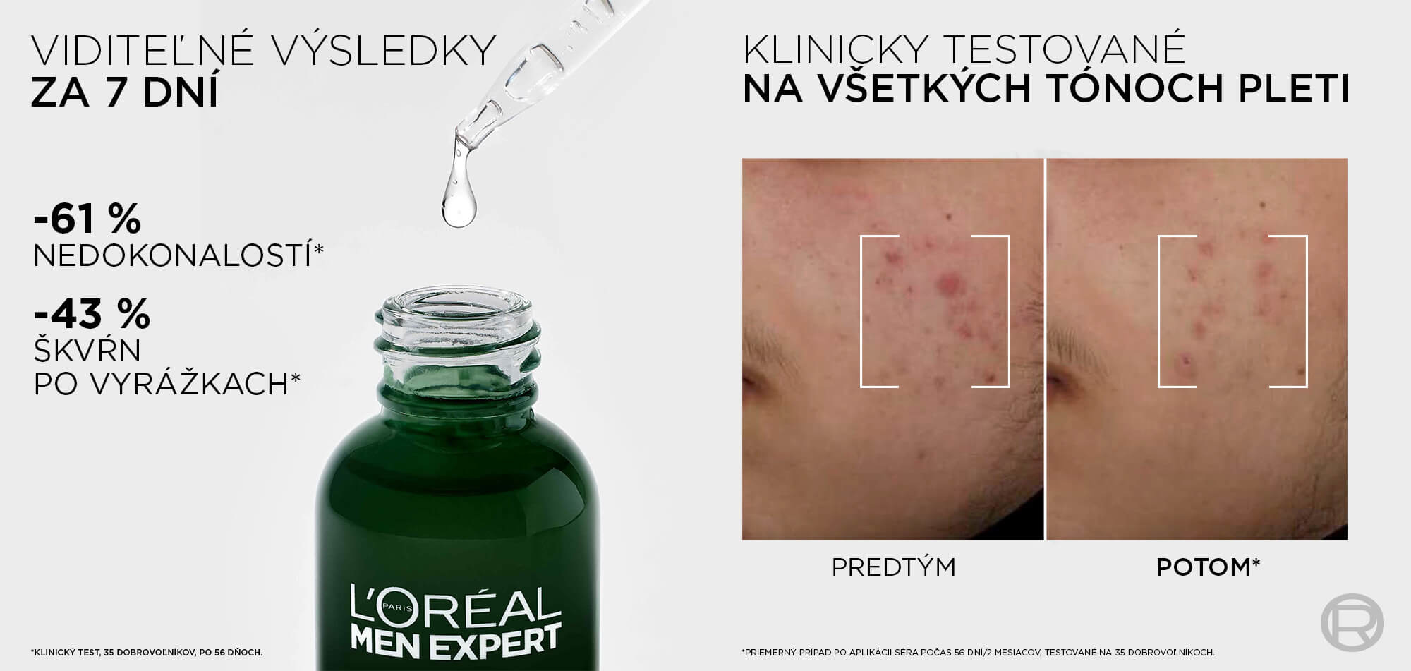 Pleťové sérum L´ORÉAL PARIS Men Expert Derma Control Niacinamide Anti-blemish 30 ml