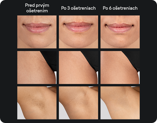 Odstraňovač chĺpkov Braun IPL Silk·expert Pro 5 PL5210