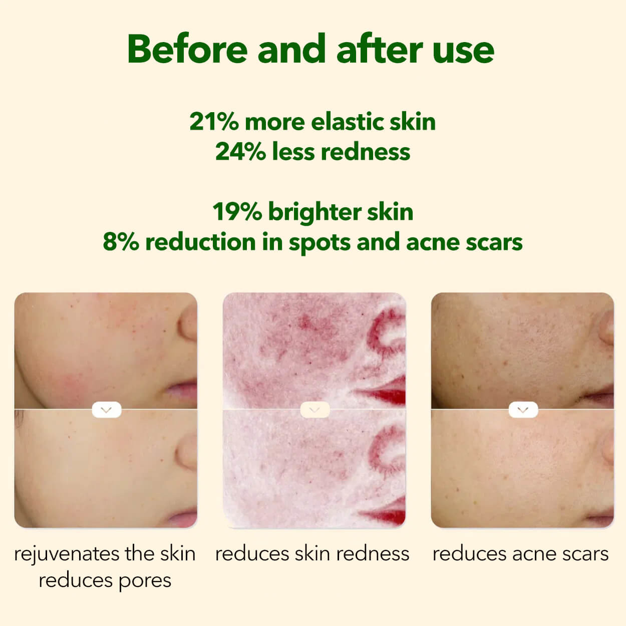 JOVS JP1P Blacken Pro DPL photofacial