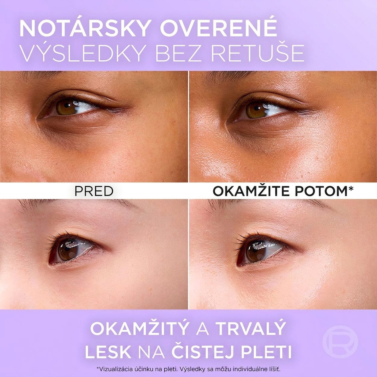 Pleťový krém L'ORÉAL PARIS Revitalift Filler Glass Skin 50 ml Pleťový krém L'ORÉAL PARIS Revitalift Filler Glass Skin 50 ml