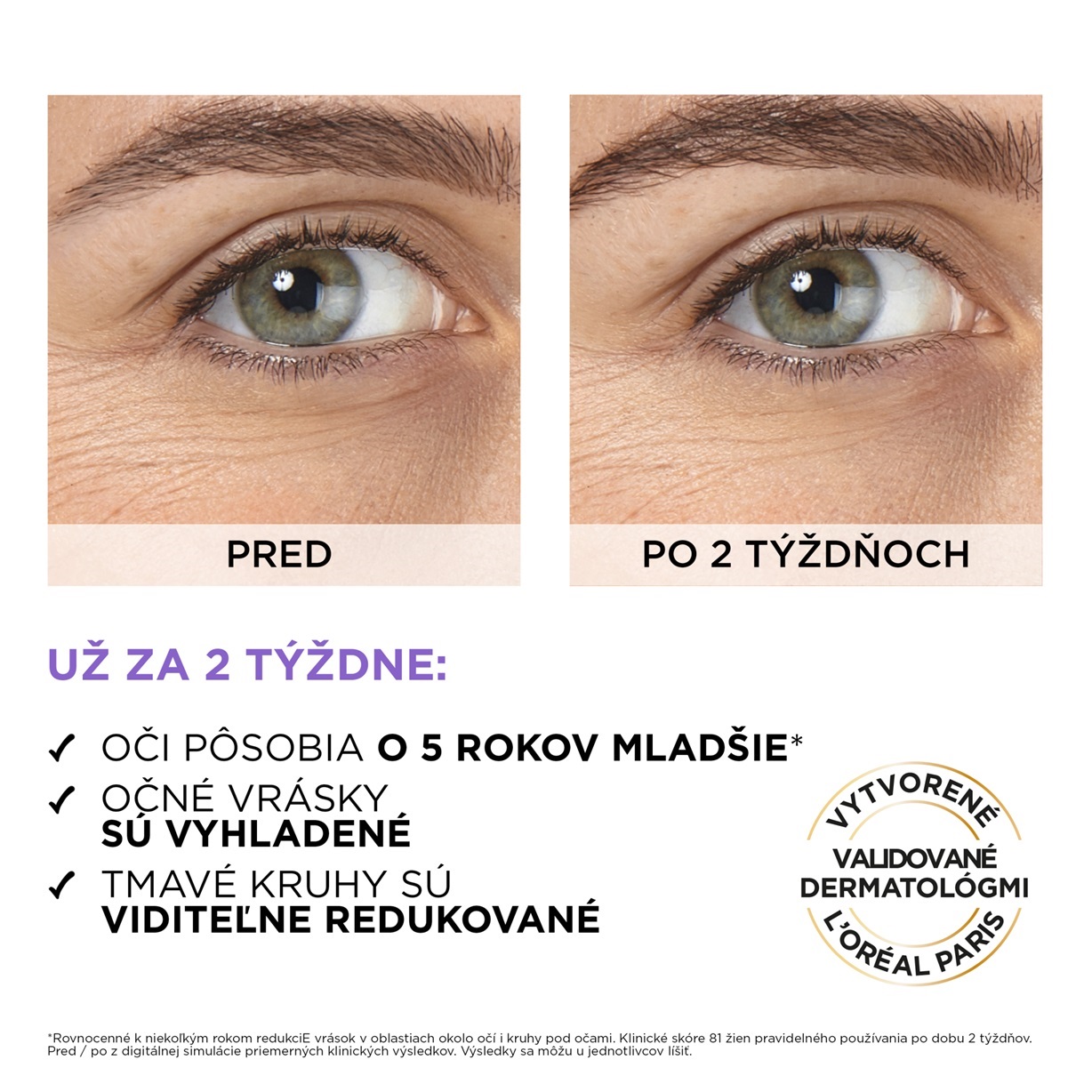Očné sérum L'ORÉAL PARIS Revitalift Filler Očné sérum s 2,5 % kyselinou hyalurónovou 20 ml