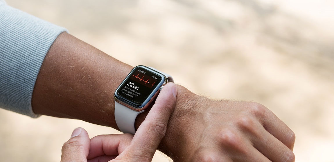 Apple Watch; EKG; egészség; wearables;