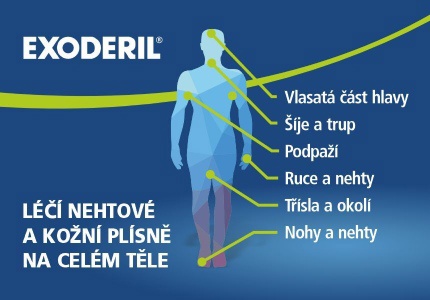 exoderil roztok a mast