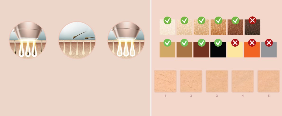 Philips Lumea Prestige IPL BRI958/00