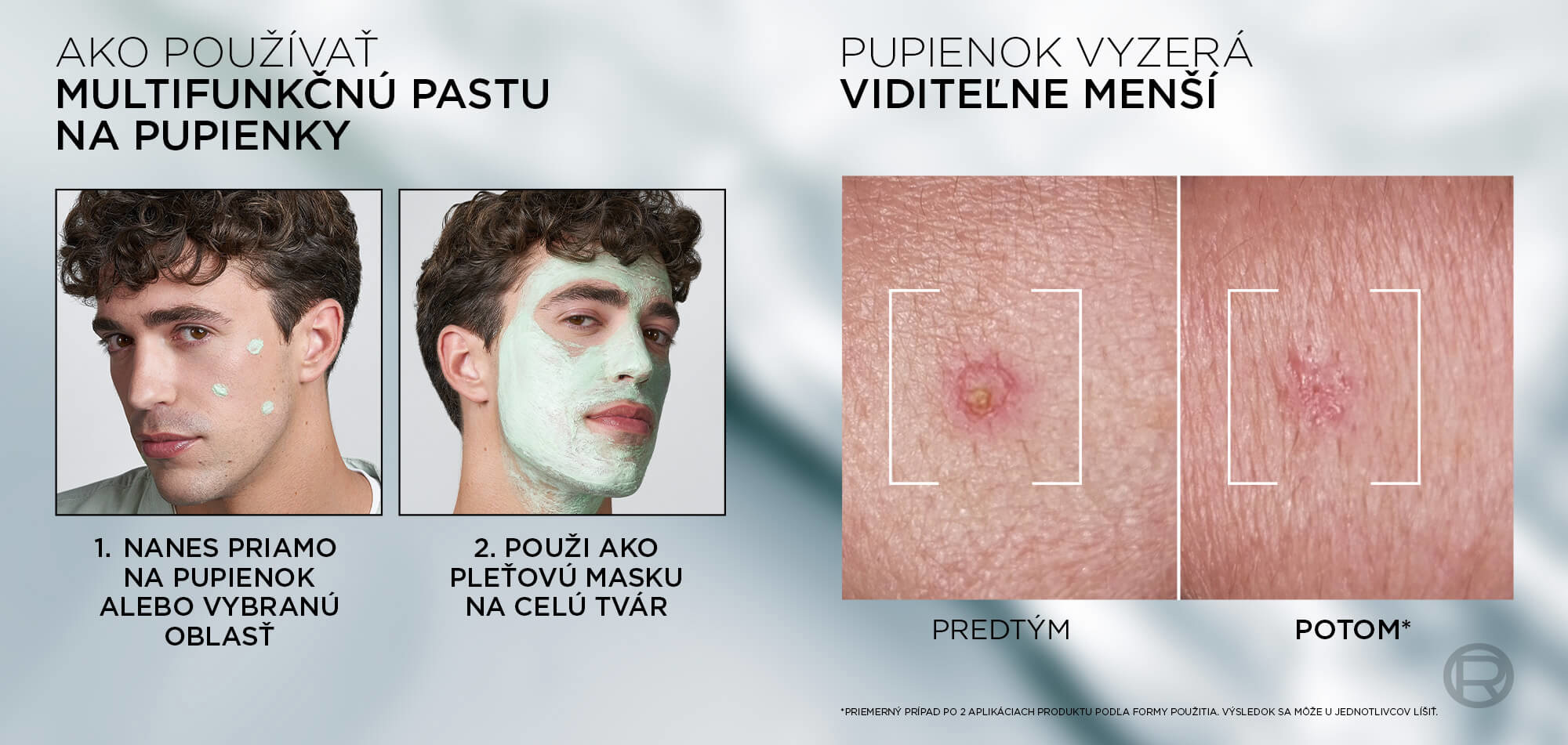 Pleťové sérum L´ORÉAL PARIS Men Expert Derma Control Niacinamide Anti-blemish 30 ml