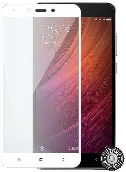 XAIOMI Redmi Note 4