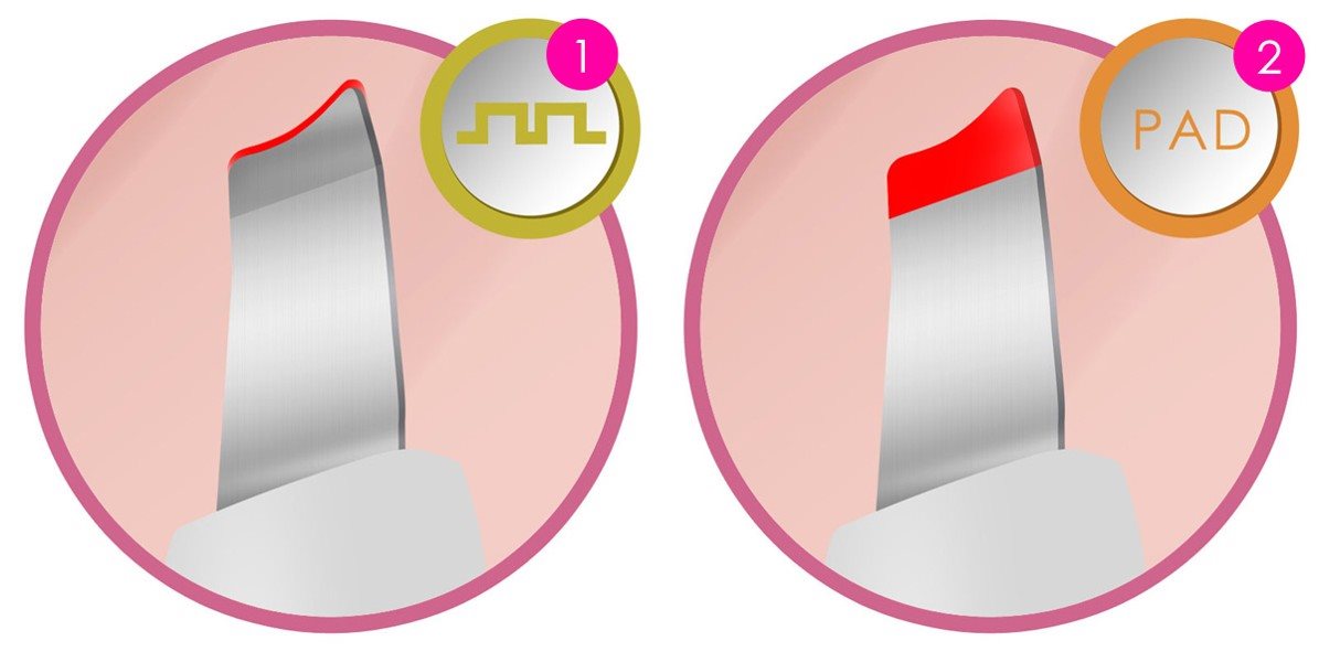 Kosmetická ultrazvuková špachtle BeautyRelax Peel&lift Smart