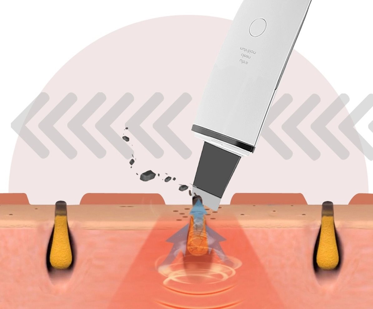 Kosmetická ultrazvuková špachtle BeautyRelax Peel&lift Premium 