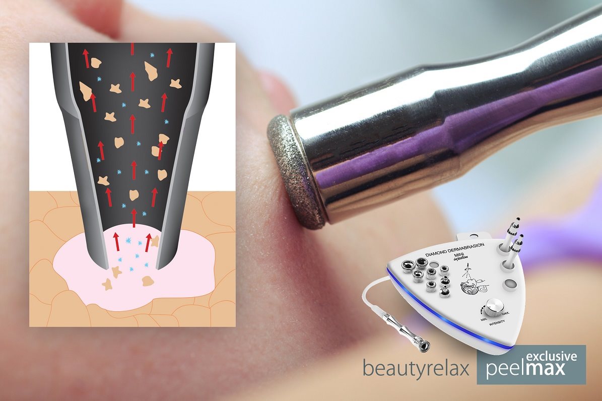 BeautyRelax Peelmax Exclusive Vacuum Skin Cleanser
