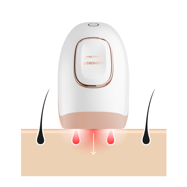 IPL epilator CONCEPT IL3000 PERFECT SKIN