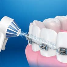 Oral-B Aquacare 4 Electric Oral Irrigator