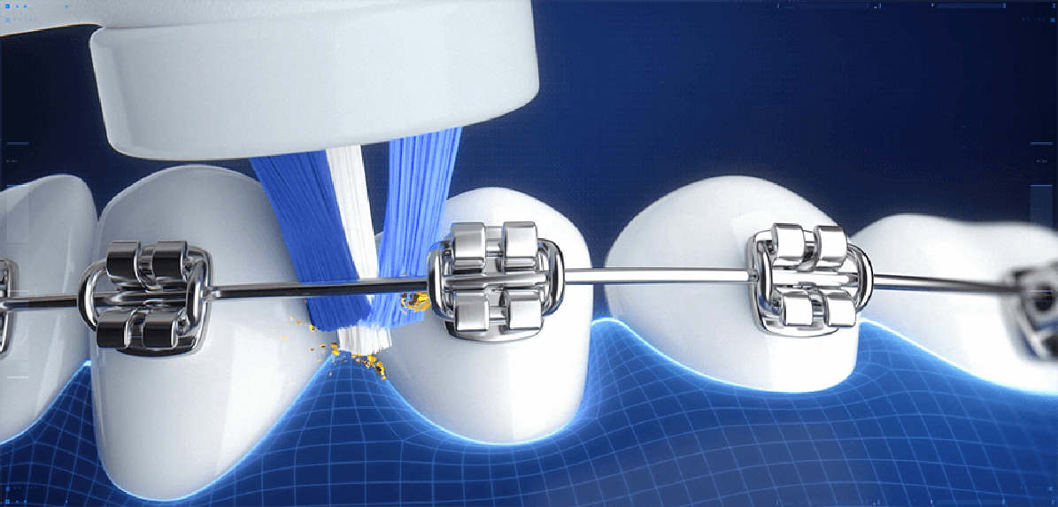 Elektrický zubní kartáček Oral-B iO Teens My Way Elektrický zubní kartáček Oral-B iO Teens My Way