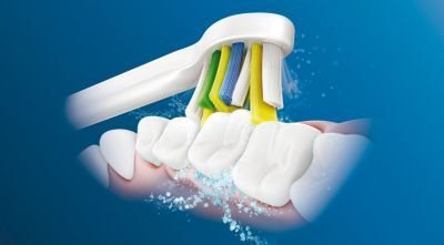 Philips Sonicare technology Philips Sonicare technology