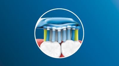Adaptable cleaning technology