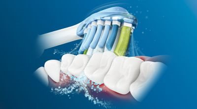 Philips Sonicare technology Philips Sonicare technology