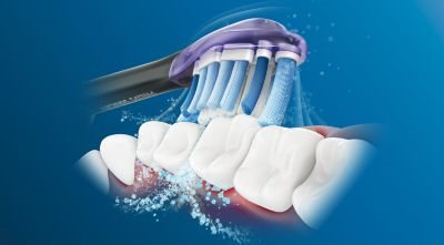 Philips Sonicare technology