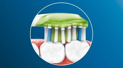 Adaptable cleaning technology