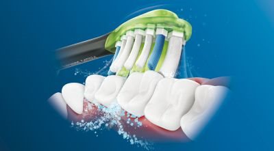 Philips Sonicare technology Philips Sonicare technology