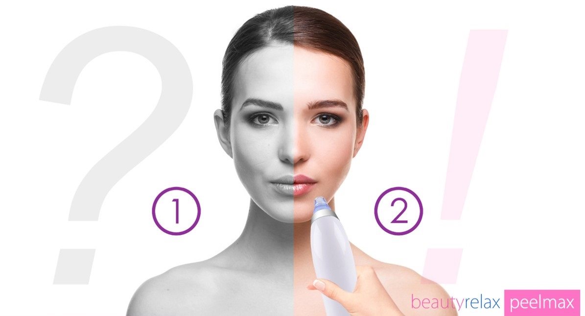BeautyRelax Peelmax Vakuum-Hautreinigungsmittel
