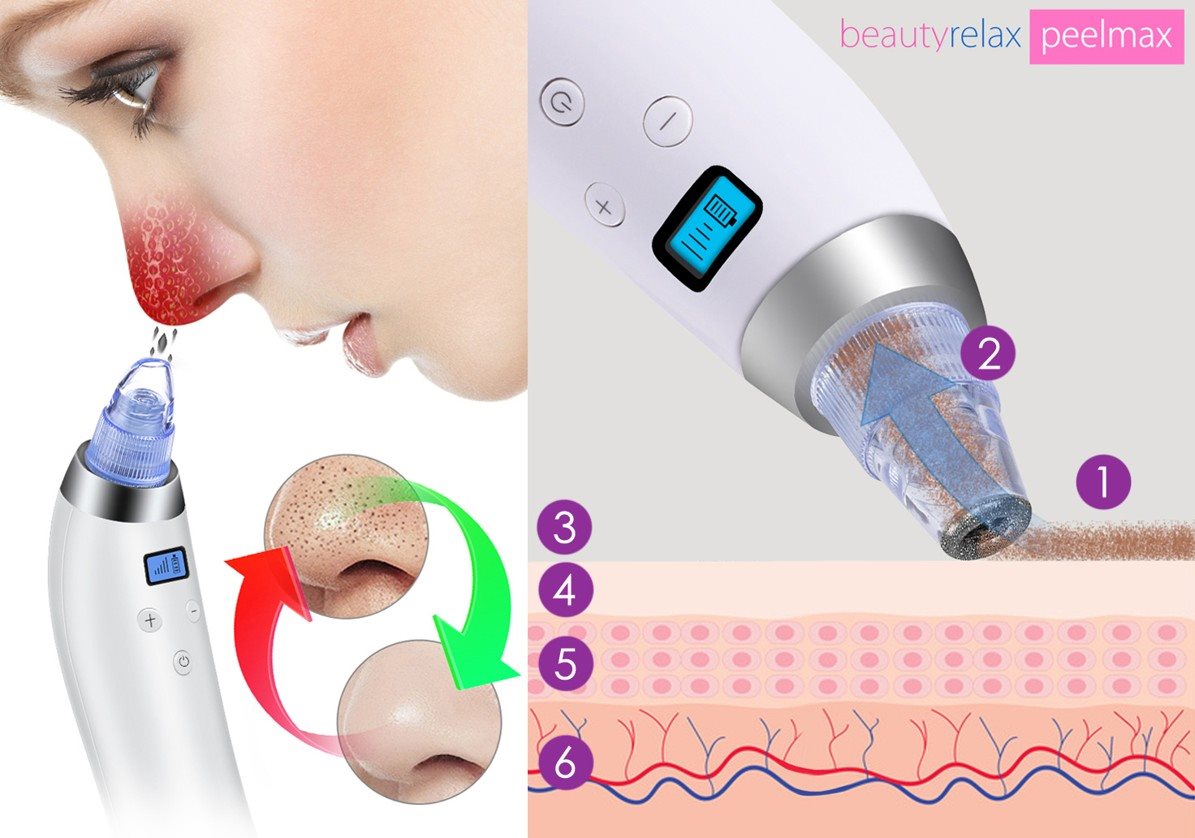 BeautyRelax Peelmax Vakuum-Hautreinigungsmittel