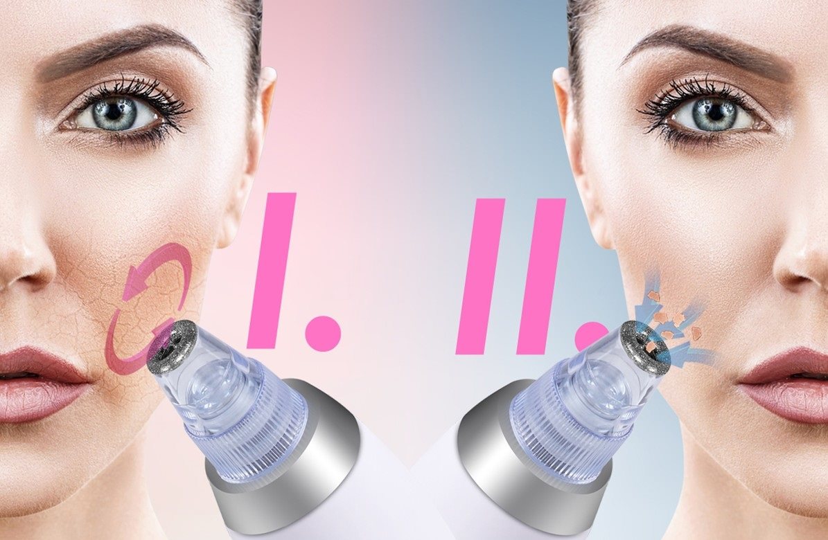 BeautyRelax Peelmax Vakuum-Hautreinigungsmittel