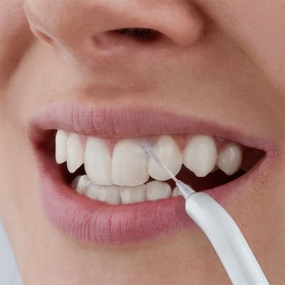 Oral shower Sencor