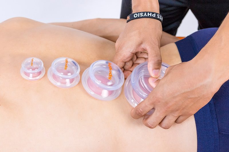 Spophy Cupping Set Massage Cups