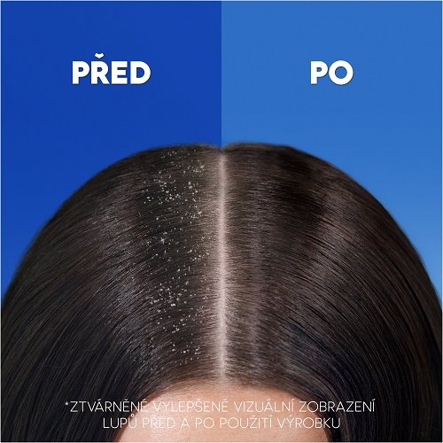 Head & Shoulders Menthol Fresh Shampoo