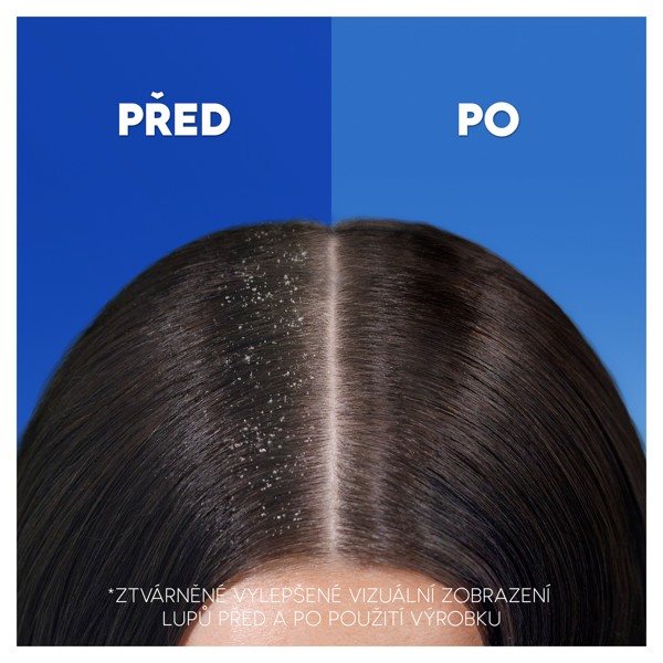 HEAD&SHOULDERS Citrus Fresh Shampoo HEAD&SHOULDERS Citrus Fresh Shampoo