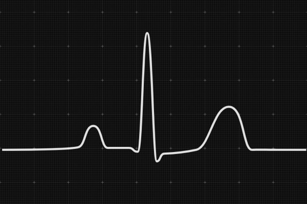 Withings Body Scan Connected Health Station - Black