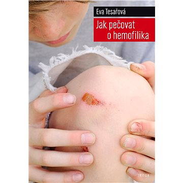 

Jak pečovat o hemofilika