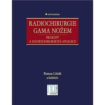 

Radiochirurgie gama nožem