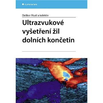 

Ultrazvukové vyšetření žil dolních končetin