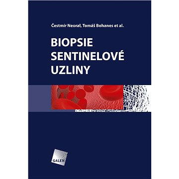 

Biopsie sentinelové uzliny