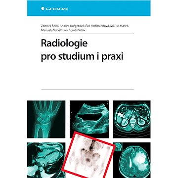

Radiologie pro studium i praxi