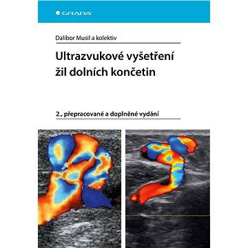 

Ultrazvukové vyšetření žil dolních končetin